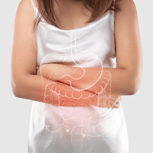 IBS Flare Ups