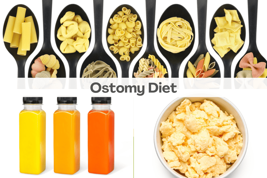 ostomy diet